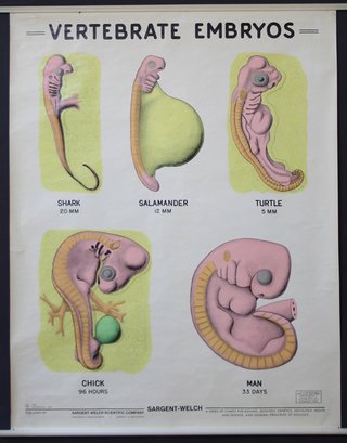 a diagram of a fetus