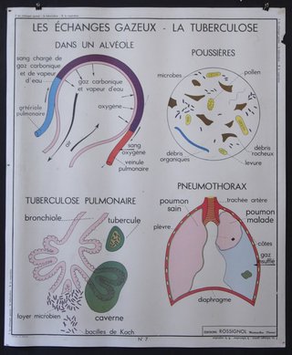 a poster with text and pictures of different types of organs