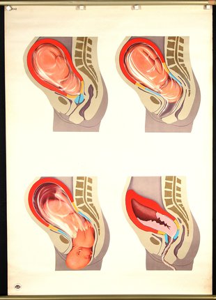 a diagram of a baby in the womb