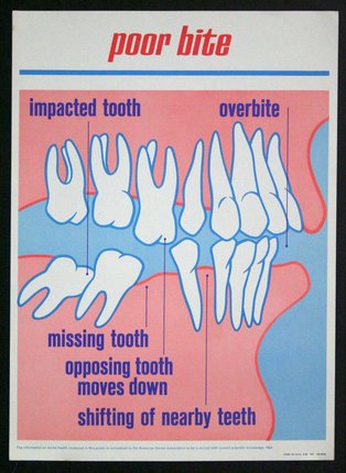 a poster showing teeth missing and overbites
