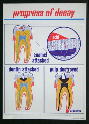 a poster showing the structure of teeth