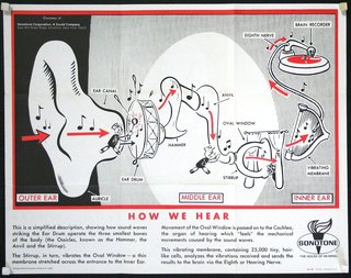 a diagram of a hearing aid